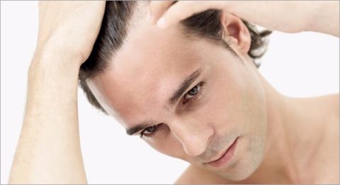 गंजापन दूर करने का घरेलु नुस्खा | Hair Loss Home Remedies In Hindi