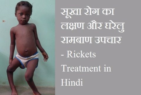 सूखा रोग का लक्षण और घरेलु रामबाण उपचार | Sukha Rog ka Upchar in Hindi