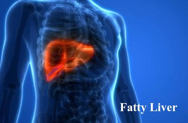 फैटी लिवर के कारण और घरेलु उपचार | Fatty Liver Treatment in Hindi